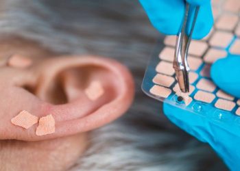auriculoterapia-funciona?-o-que-dizem-as-evidencias