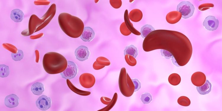 a-luta-invisivel-dos-brasileiros-com-doenca-falciforme