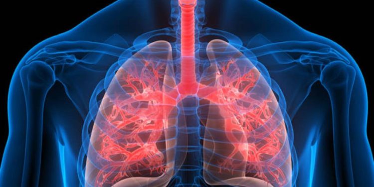 anticoagulante-popular-demonstra-potencial-para-tratar-inflamacao-pulmonar