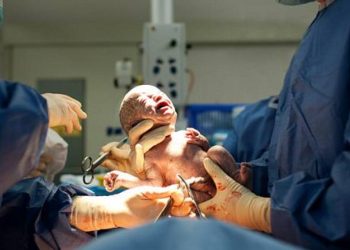 vidas-de-milhoes-de-bebes-podem-mudar-com-simples-teste-do-cordao-umbilical;-entenda