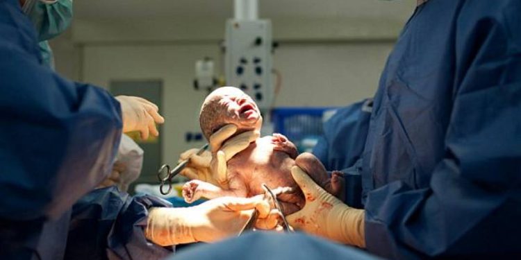 vidas-de-milhoes-de-bebes-podem-mudar-com-simples-teste-do-cordao-umbilical;-entenda