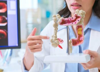 casos-de-cancer-de-intestino-no-pais-devem-saltar-21%-nos-proximos-15-anos