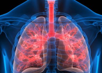 cancer-de-pulmao:-estudo-mapeia-terapia-que-oferece-maior-sobrevida-em-tipo-raro