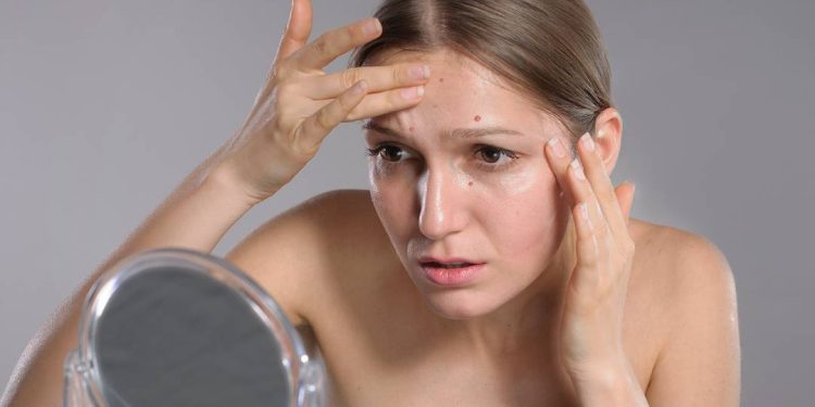 o-que-o-ciclo-menstrual-tem-a-ver-com-quatro-doencas-de-pele