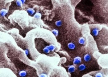 cura-do-hiv-segue-distante,-mas-descoberta-cientifica-renova-esperanca