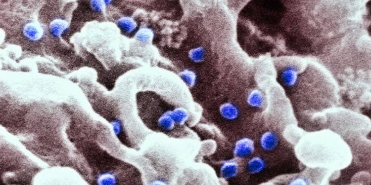 cura-do-hiv-segue-distante,-mas-descoberta-cientifica-renova-esperanca