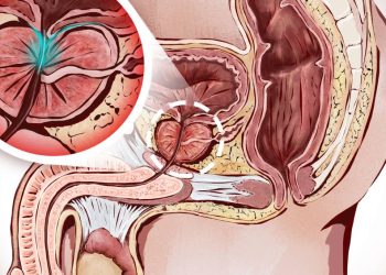 cancer-de-prostata:-diagnostico-de-personalidades-e-um-convite-ao-cuidado