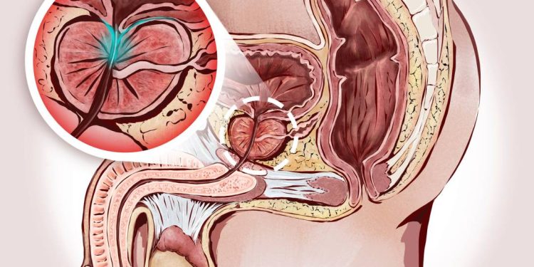 cancer-de-prostata:-diagnostico-de-personalidades-e-um-convite-ao-cuidado