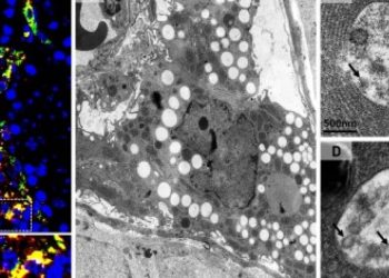 covid:-virus-usa-celulas-dos-testiculos-para-se-multiplicar;-entenda