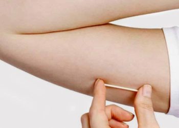 implante-contraceptivo-que-custa-ate-r$-4-mil-e-incorporado-no-sus