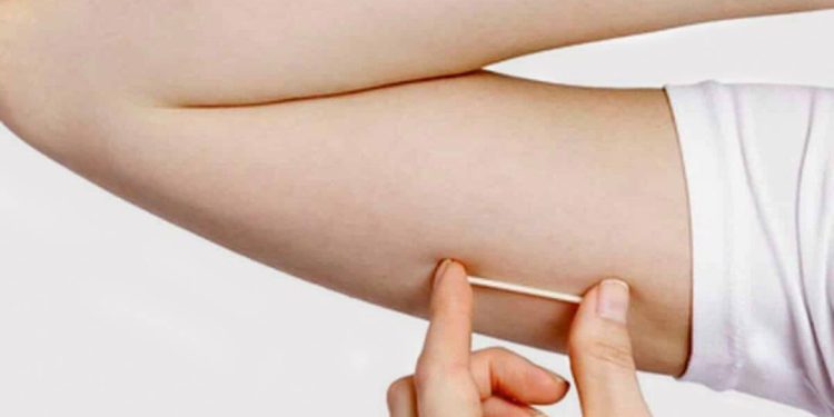 implante-contraceptivo-que-custa-ate-r$-4-mil-e-incorporado-no-sus