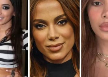o-que-ha-de-fato-por-tras-das-mudancas-no-visual-de-anitta