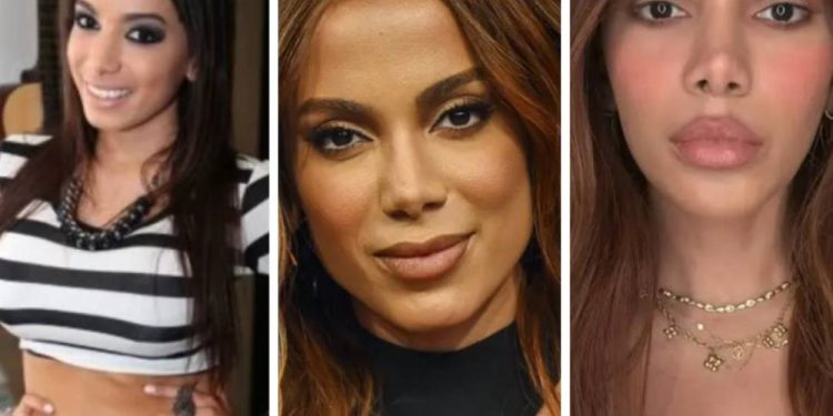 o-que-ha-de-fato-por-tras-das-mudancas-no-visual-de-anitta