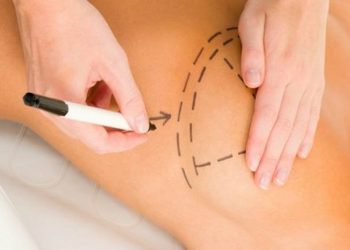 sus-amplia-acesso-a-cirurgia-de-reconstrucao-mamaria-para-alem-dos-casos-de-cancer