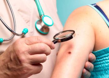 a-faixa-etaria-em-que-o-cancer-de-pele-disparou-no-brasil