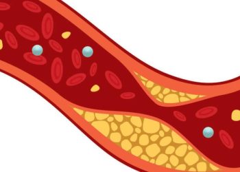 colesterol-ainda-nao-e-visto-como-risco-para-doencas-cardiovasculares