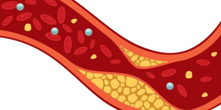 colesterol-ainda-nao-e-visto-como-risco-para-doencas-cardiovasculares