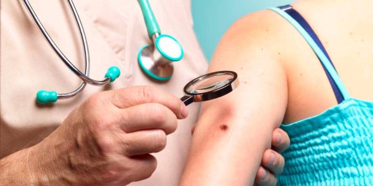 como-a-ia-pode-auxiliar-no-diagnostico-precoce-do-cancer-de-pele?