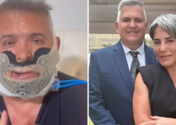 o-motivo-da-cirurgia-no-rosto-de-orlando-morais,-marido-de-gloria-pires