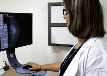ministerio-da-saude-recomenda-mamografia-no-sus-a-partir-dos-40-anos
