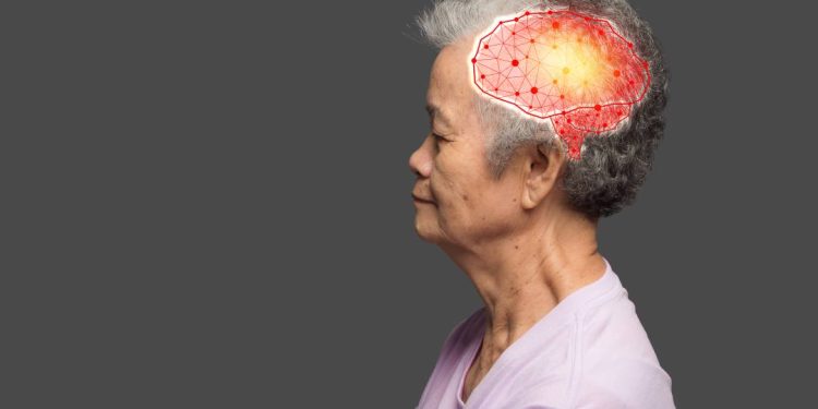 cerebro-de-homens-encolhe-mais-rapido-que-o-de-mulheres:-o-que-isso-diz-sobre-o-alzheimer?