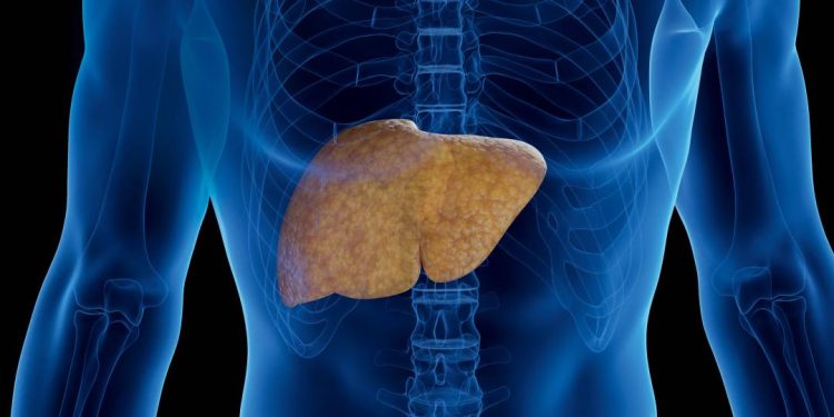 nem-o-alcool-nem-os-virus-por-tras-da-hepatite:-saiba-qual-e-o-maior-inimigo-do-figado
