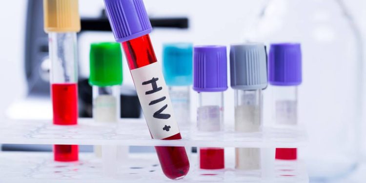 brasil-atinge-menor-patamar-de-transmissao-do-hiv-de-mae-para-filho