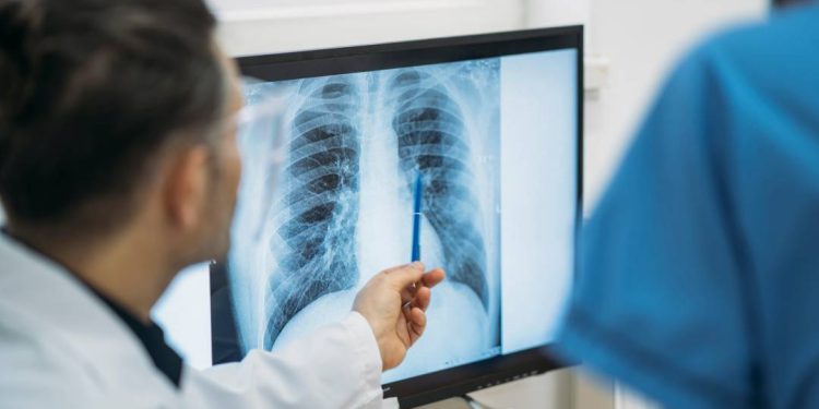 brasil-nao-alcanca-meta-da-oms-para-controle-da-tuberculose
