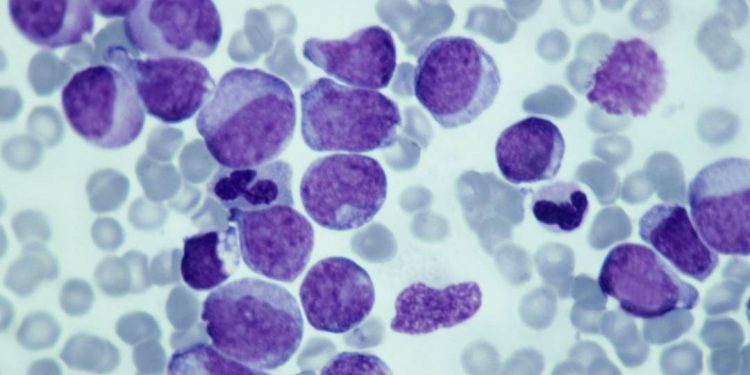 como-as-terapias-alvo-estao-mudando-o-tratamento-do-cancer