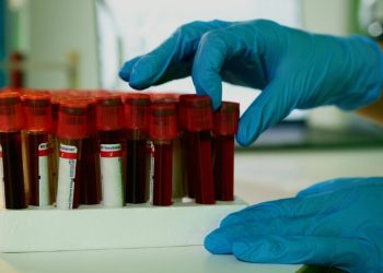 caes-treinados-conseguem-detectar-sinais-de-cancer-em-amostras-de-sangue