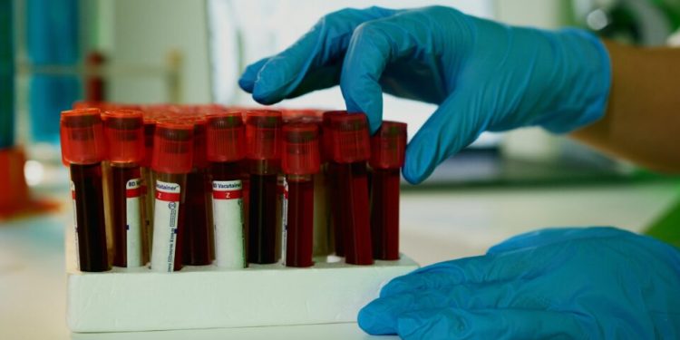 caes-treinados-conseguem-detectar-sinais-de-cancer-em-amostras-de-sangue