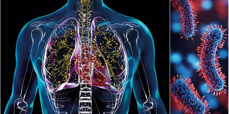 velha-inimiga:-por-que-a-tuberculose-ainda-nao-e-uma-doenca-do-passado