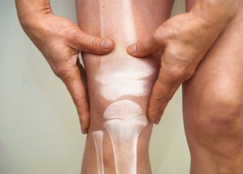 anvisa-aprova-novo-medicamento-para-artrite-reumatoide-e-outras-doencas-inflamatorias