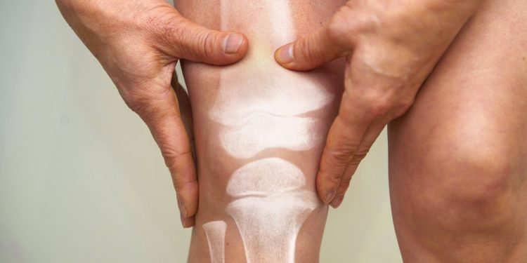 anvisa-aprova-novo-medicamento-para-artrite-reumatoide-e-outras-doencas-inflamatorias