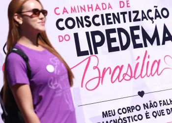 Lipedema: doença crônica vai além da questão estética